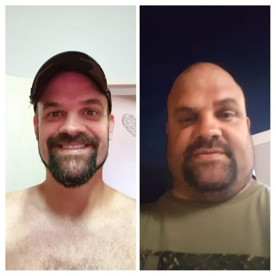 Keto Diet & Intermittent Fasting South Africa Before and After